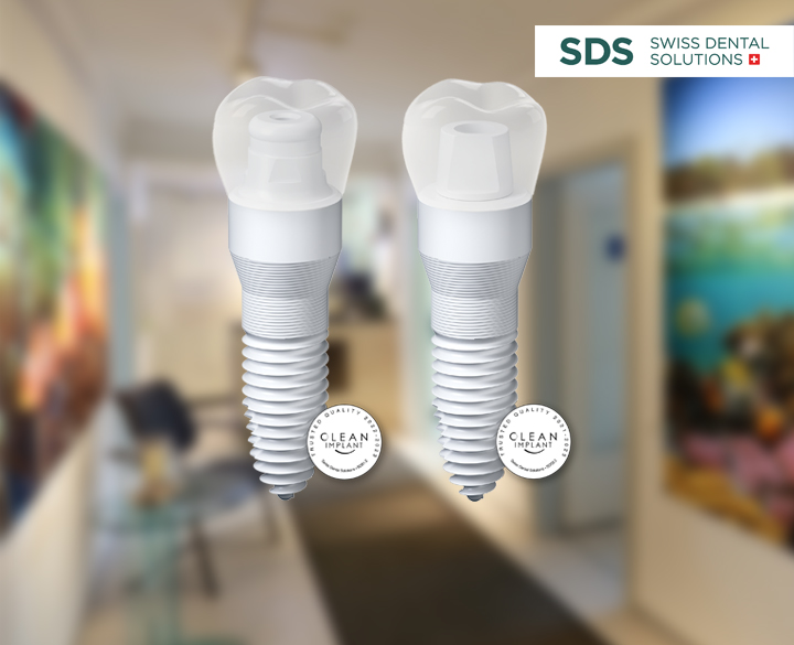 implantate02 implantate02